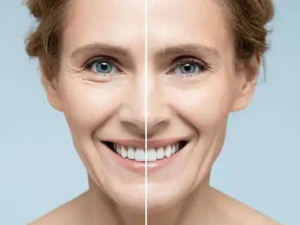 Signs of Aging Targeted by Dermal Fillers - Natural Beauty NYC