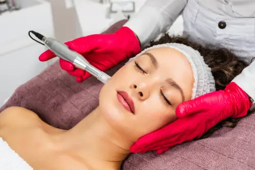 What to Expect from CosmoPen Microneedling Treatments - Natural Beauty goes Over Step by Step Of What Happens Using CosmoPen Microneedling What to Expect from CosmoPen Microneedling Treatments - Natural Beauty goes Over Step by Step Of What Happens Using CosmoPen Microneedling