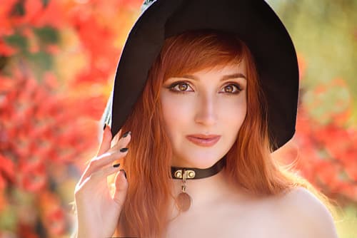 Radiesse dermal fillers injectables Natural Beauty NYC Charles Jovellano