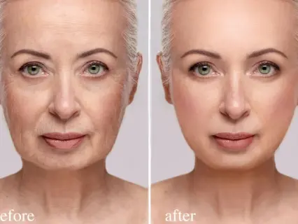 Target Facial Changes with Seoul Smooth + Sculpt - Natural Beauty NYC Is Who to See Target Facial Changes with Seoul Smooth + Sculpt - Natural Beauty NYC Is Who to See